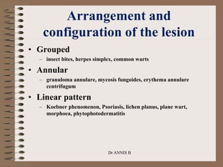 Arrangement and
configuration of the lesion
• Grouped
– insect bites, herpes simplex, common warts
• Annular
– granuloma annulare, mycosis fungoides, erythema annulare
centrifugum
• Linear pattern
– Koebner phenomenon, Psoriasis, lichen planus, plane wart,
morphoea, phytophotodermatitis
Dr ANNIS B
 