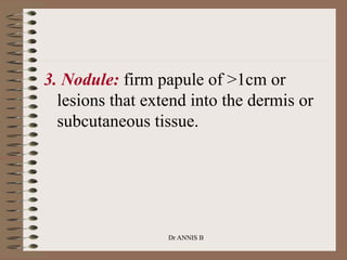 3. Nodule: firm papule of >1cm or
lesions that extend into the dermis or
subcutaneous tissue.
Dr ANNIS B
 