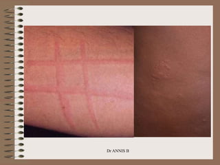 Dr ANNIS B
 