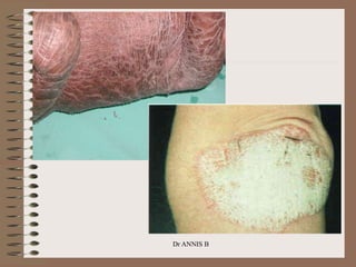 Dr ANNIS B
 