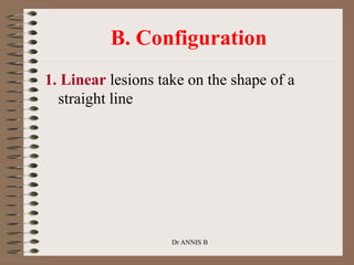 B. Configuration
1. Linear lesions take on the shape of a
straight line
Dr ANNIS B
 
