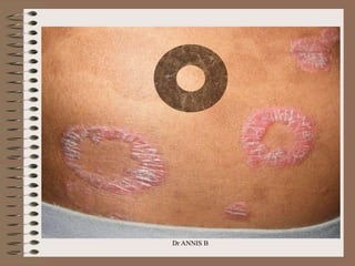 Dr ANNIS B
 
