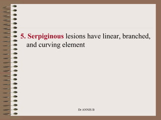 5. Serpiginous lesions have linear, branched,
and curving element
Dr ANNIS B
 