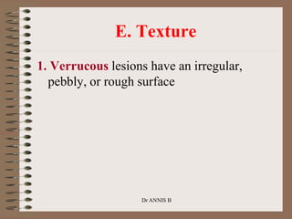 E. Texture
1. Verrucous lesions have an irregular,
pebbly, or rough surface
Dr ANNIS B
 