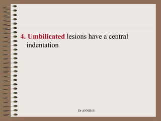 4. Umbilicated lesions have a central
indentation
Dr ANNIS B
 