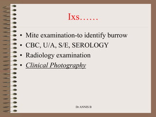 Ixs……
• Mite examination-to identify burrow
• CBC, U/A, S/E, SEROLOGY
• Radiology examination
• Clinical Photography
Dr ANNIS B
 
