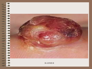 Dr ANNIS B
 