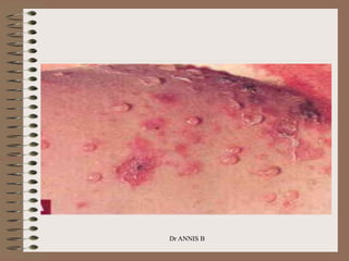 Dr ANNIS B
 