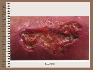 Dr ANNIS B
 