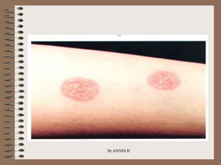 Dr ANNIS B
 