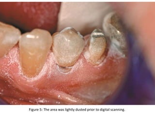 Figure 5: The area was lightly dusted prior to digital scanning.
 