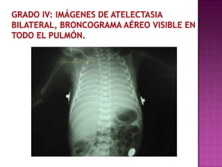 6 diagnóstico1. Factores de riesgo2.Cuadro clínico3.Estudios de laboratorio4. Radiología