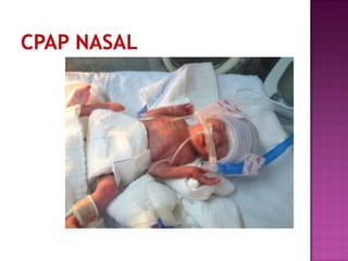 Monitorización fetal continua.