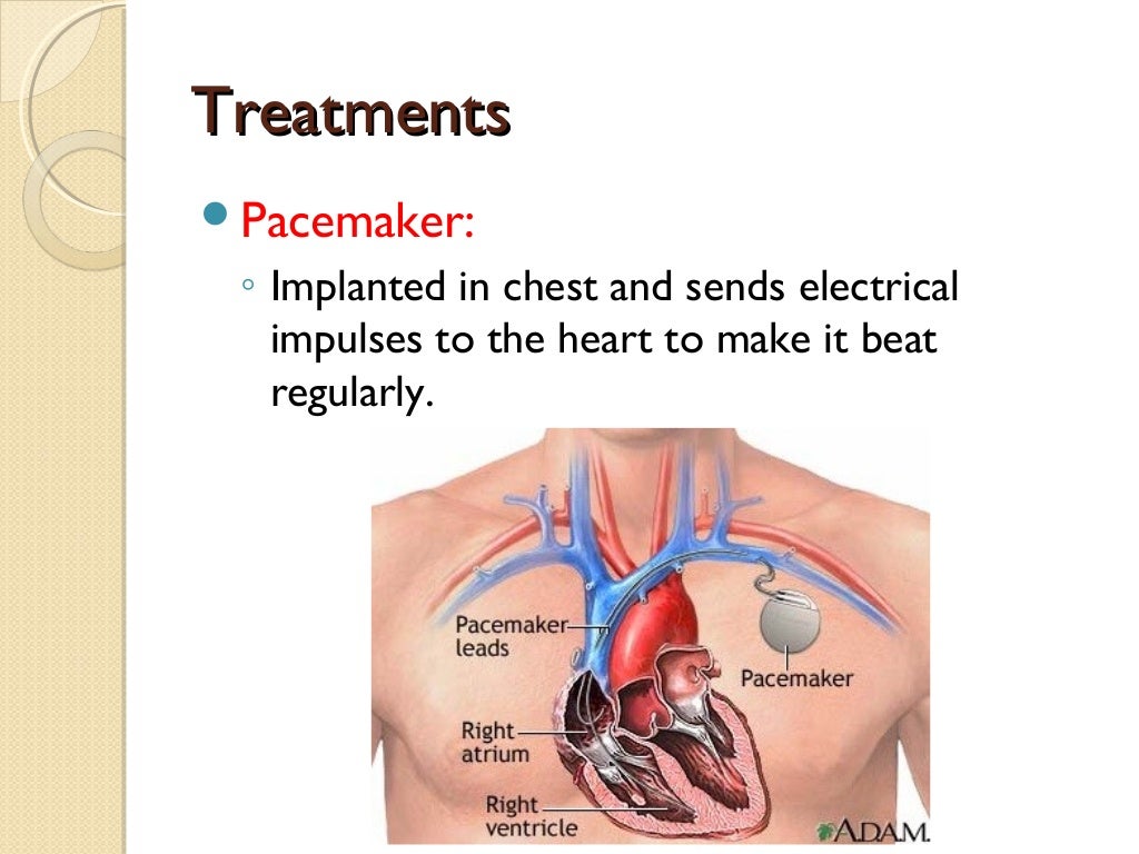 3 non communicable diseases