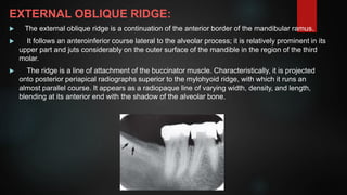 Posterior Ridge 3 normal anatomy IOPA.pptx