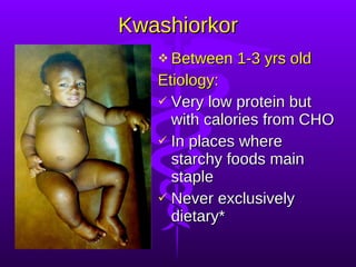 Kwashiorkor Between 1-3 yrs old Etiology: Very low protein but with calories from CHO In places where starchy foods main staple Never exclusively dietary* 
