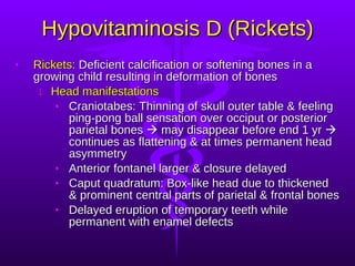 Hypovitaminosis D (Rickets) Rickets:  Deficient calcification or softening bones in a growing child resulting in deformation of bones Head manifestations Craniotabes: Thinning of skull outer table & feeling ping-pong ball sensation over occiput or posterior parietal bones    may disappear before end 1 yr    continues as flattening & at times permanent head asymmetry Anterior fontanel larger & closure delayed Caput quadratum: Box-like head due to thickened & prominent central parts of parietal & frontal bones Delayed eruption of temporary teeth while permanent with enamel defects 
