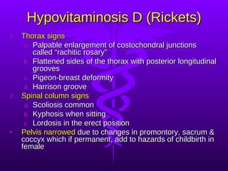 Hypovitaminosis D (Rickets) Thorax signs Palpable enlargement of costochondral junctions called “rachitic rosary” Flattened sides of the thorax with posterior longitudinal grooves Pigeon-breast deformity Harrison groove Spinal column signs Scoliosis common Kyphosis when sitting Lordosis in the erect position Pelvis narrowed  due to changes in promontory, sacrum & coccyx which if permanent, add to hazards of childbirth in female 