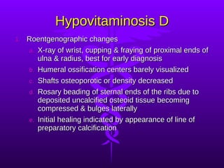 Hypovitaminosis D Roentgenographic changes X-ray of wrist, cupping & fraying of proximal ends of ulna & radius, best for early diagnosis Humeral ossification centers barely visualized Shafts osteoporotic or density decreased Rosary beading of sternal ends of the ribs due to deposited uncalcified osteoid tissue becoming compressed & bulges laterally  Initial healing indicated by appearance of line of preparatory calcification 