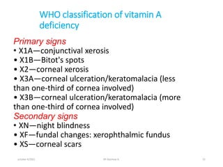 WHO classification of vitamin A
deficiency
Primary signs
• X1A—conjunctival xerosis
• X1B—Bitot's spots
• X2—corneal xerosis
• X3A—corneal ulceration/keratomalacia (less
than one-third of cornea involved)
• X3B—corneal ulceration/keratomalacia (more
than one-third of cornea involved)
Secondary signs
• XN—night blindness
• XF—fundal changes: xerophthalmic fundus
• XS—corneal scars
october 6/2021 BY:Ayichew A. 51
 