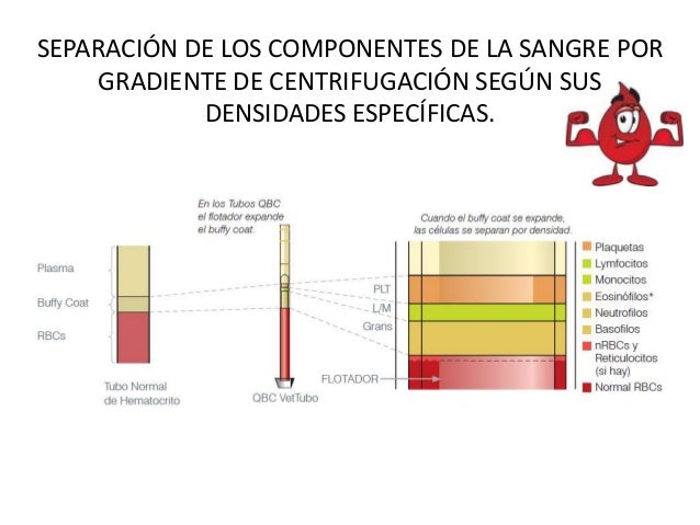 Eje 5