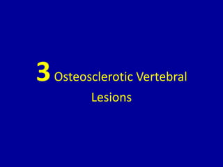 3Osteosclerotic Vertebral
Lesions
 