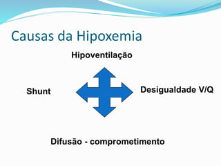 Hipoventilação
Shunt Desigualdade V/Q
Difusão - comprometimento
Causas da Hipoxemia
 