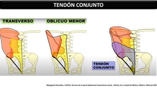 TENDÓN CONJUNTO
Mayagoitia González, J (2015). Hernias de la pared abdominal tratamiento actual.. Edición 3ra. Ciudad de México, México. Editorial Alfil
 