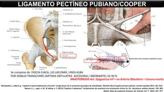Se compone de FASCIA ILIACA, LIG LACUNAR, LINEA ALBA
POR DEBAJO TRANSCURRE (ARTERIA OBTULATRIZ ACCESORIA / ABERRANTE) 10-30 %
LIGAMENTO PECTÍNEO PUBIANO/COOPER
ARTERIA OBTULATRIZ ACCESORIA / ABERRANTE) 10-30 %
ANASTOMOSIS Art. Epigastrica Inf + na Arteria Obtulatriz = Corona mortis
Skandalakis j, colborn g, “capitulo 9 pared abdominal y hernias” cirugía bases de la anatomía quirúrgica de skandalakis. Marbán libros España primera edición, versión español 2013. 351-416.
Moore, k. L., agur, a. M., & dalley, a. F. (2015).”Capítulo 5 abdomen” fundamentos de anatomía con orientación clínica 5a. Ed.. Barcelona: wolters kluwer. 765- 803
Netter. Atlas de anatomía humana. Ed. Elsevier. Ed. 7°. 2019. 457 -477
 