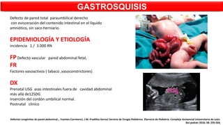 Defecto de pared total paraumbilical derecho
con evisceración del contenido intestinal en el líquido
amniótico, sin saco herniario.
EPIDEMIOLOGÍA Y ETIOLOGÍA
incidencia 1 / 3.000 RN
FP Defecto vascular pared abdominal fetal,
FR
Factores vasoactivos ( tabaco ,vasoconstrictores)
DX
Prenatal USG asas intestinales fuera de cavidad abdominal
más allá de12SDG
Inserción del cordón umbilical normal.
Postnatal clínico
GASTROSQUISIS
Defectos congénitos de pared abdominal.,. Fuentes-Carretero1, J.M. Pradillos-Serna1 Servicio de Cirugía Pediátrica. 2Servicio de Pediatría. Complejo Asistencial Universitario de León.
Bol pediatr 2018; 58: 259-264,
 