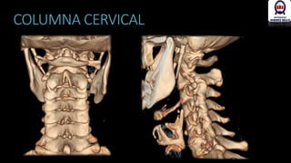 Patología radiológica de la columna vertebral | PPTX