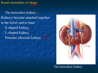 3pediatric urology, anomaly.pdf, urinogenital | PDF
