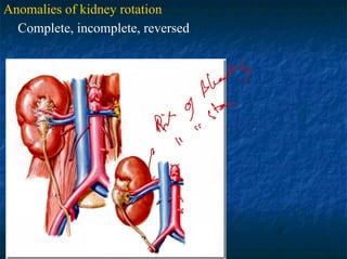 Kidney Rotation 3pediatric urology, anomaly.pdf, urinogenital | PDF