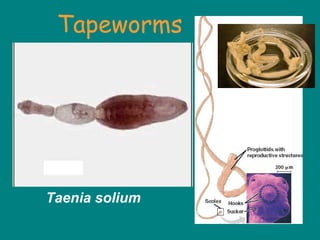 Taenia solium
Tapeworms
 