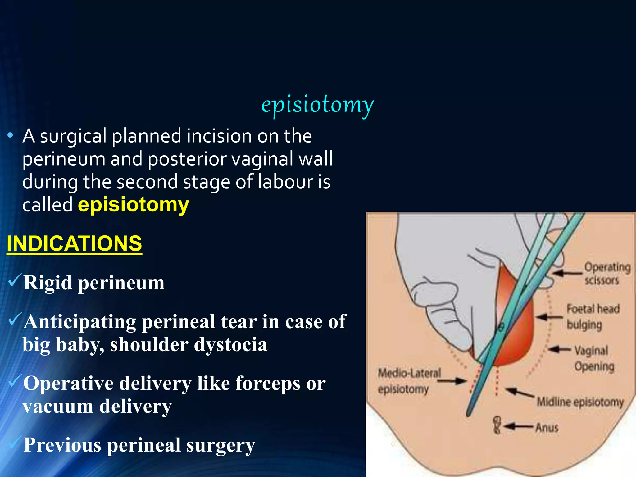Classical Incision Labour Physiology and Mangement of 2nd stage labour | PPTX