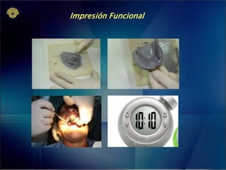 Impresión Funcional

 