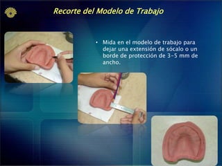 Recorte del Modelo de Trabajo

• Mida en el modelo de trabajo para
dejar una extensión de sócalo o un
borde de protección de 3-5 mm de
ancho.

 