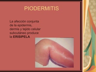 PIODERMITIS La afección conjunta de la epidermis, dermis y tejido celular subcutáneo produce la  ERISIPELA  