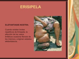 ERISIPELA ELEFANTIASIS NOSTRA : Cuando existen brotes repetitivos de Erisipela, la afección de los vasos linfáticos ocasiona fibrosis de los mismos y originan estados elefantiásicos. 