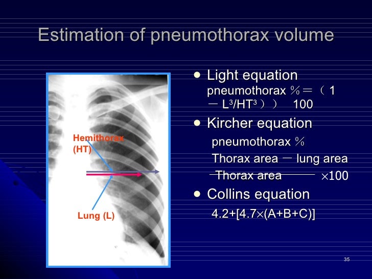 3 pneumothorax