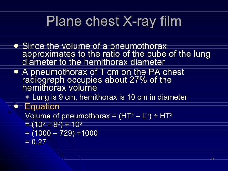 3 pneumothorax