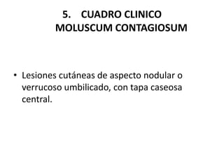 5. CUADRO CLINICO
MOLUSCUM CONTAGIOSUM
• Lesiones cutáneas de aspecto nodular o
verrucoso umbilicado, con tapa caseosa
central.