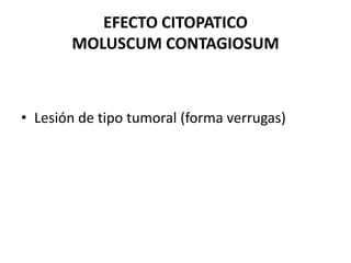 EFECTO CITOPATICO
MOLUSCUM CONTAGIOSUM
• Lesión de tipo tumoral (forma verrugas)