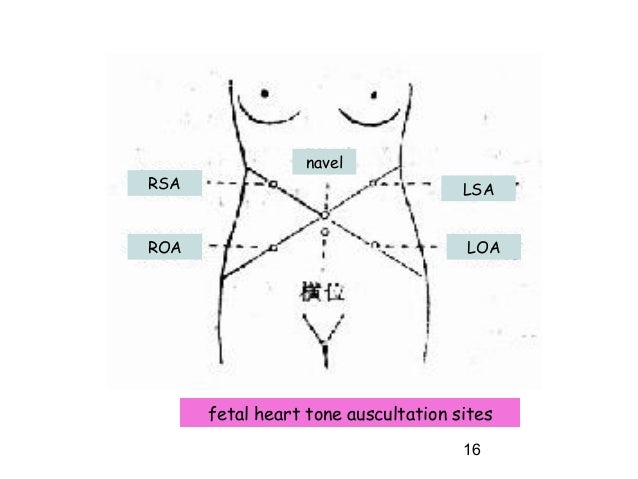 fetal heart tone
