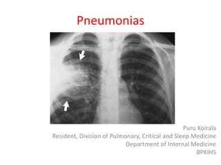 Puru Koirala
Resident, Division of Pulmonary, Critical and Sleep Medicine
Department of Internal Medicine
BPKIHS
Pneumonias
 