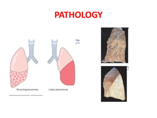 PATHOLOGY
 