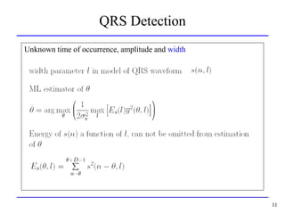 QRS detection is important in all kinds of ECG signal processing | PPT