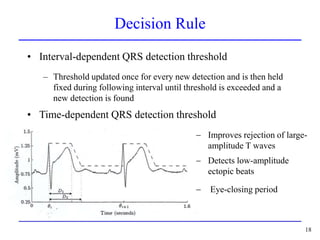 QRS detection is important in all kinds of ECG signal processing | PPT