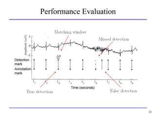 QRS detection is important in all kinds of ECG signal processing | PPT