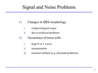 QRS detection is important in all kinds of ECG signal processing | PPT